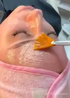 Painless Rejuvenation image thumbnail 2